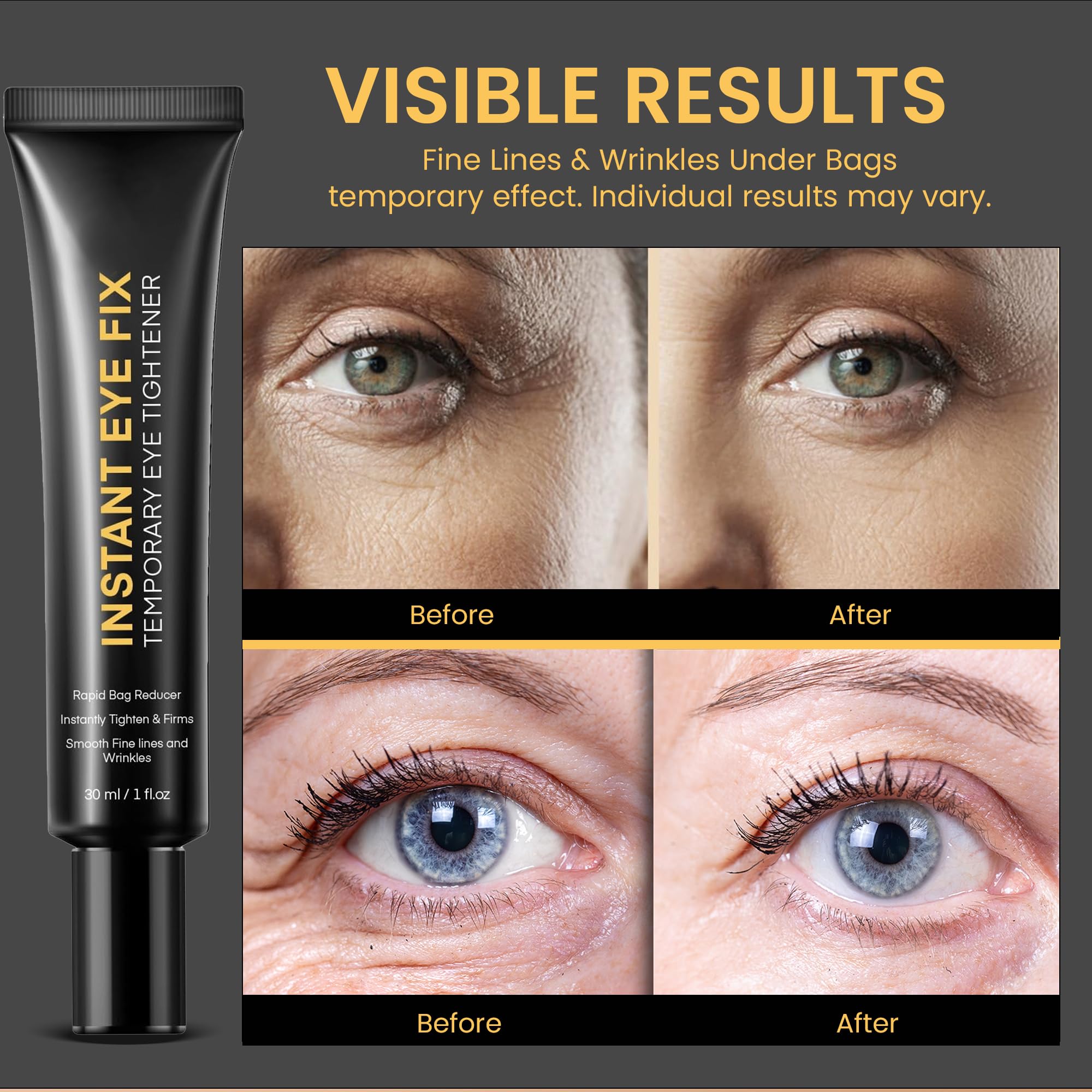 Before and after style visual of improved under-eye appearance