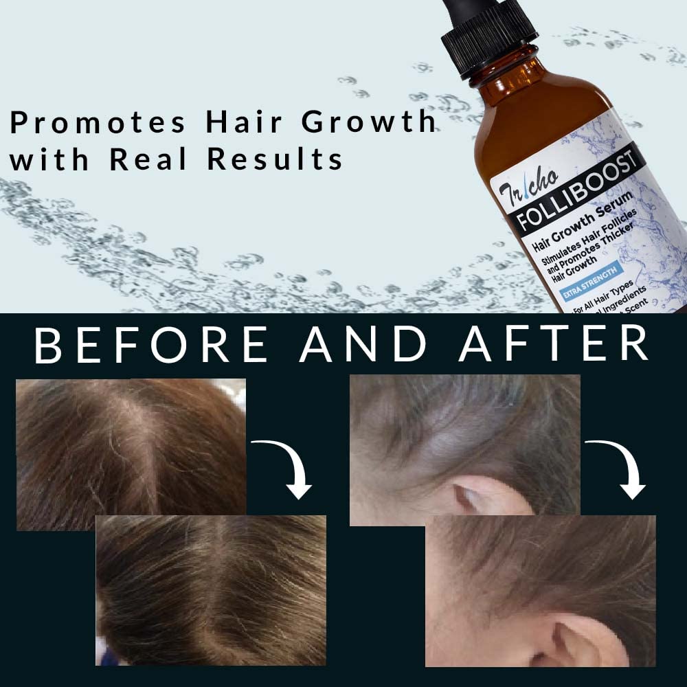 Folliboost patented extracts Anagain and Baicapil indicating root-level stimulation potential.