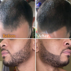FOLLICLE BOOSTER Beard Pen tip close-up highlights precise application for natural-looking results.