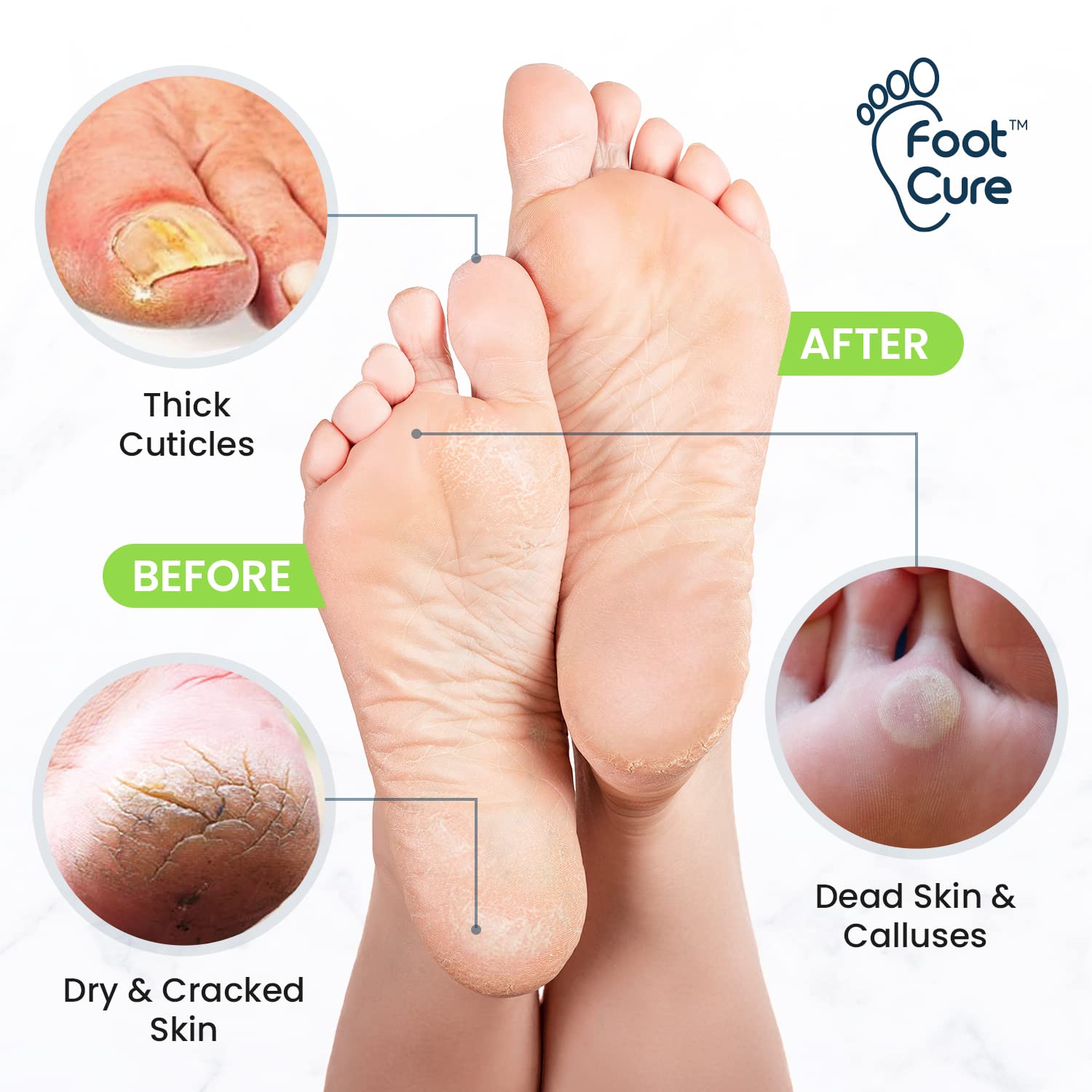 Foot Cure 2-in-1 Foot Care Kit packaging for at-home pedicures.