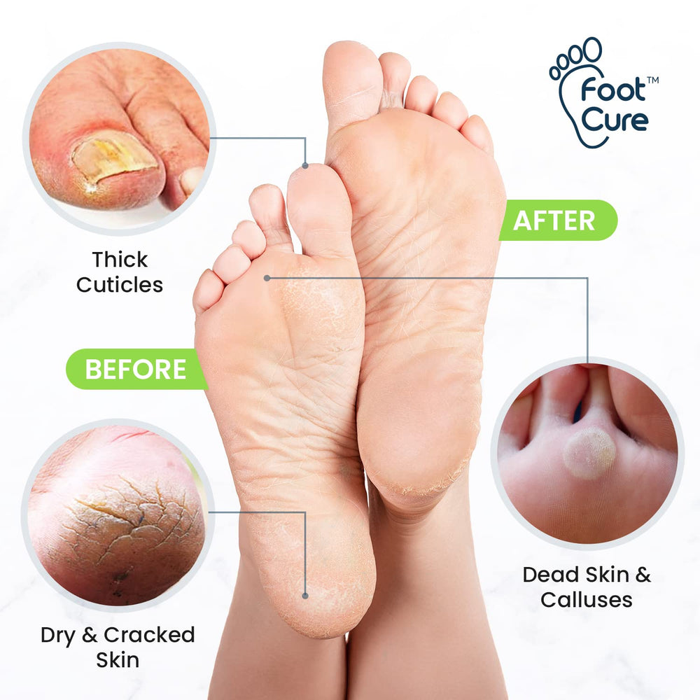 Foot Cure 2-in-1 Foot Care Kit packaging for at-home pedicures.