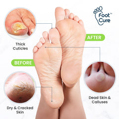 Foot Cure 2-in-1 Foot Care Kit packaging for at-home pedicures.