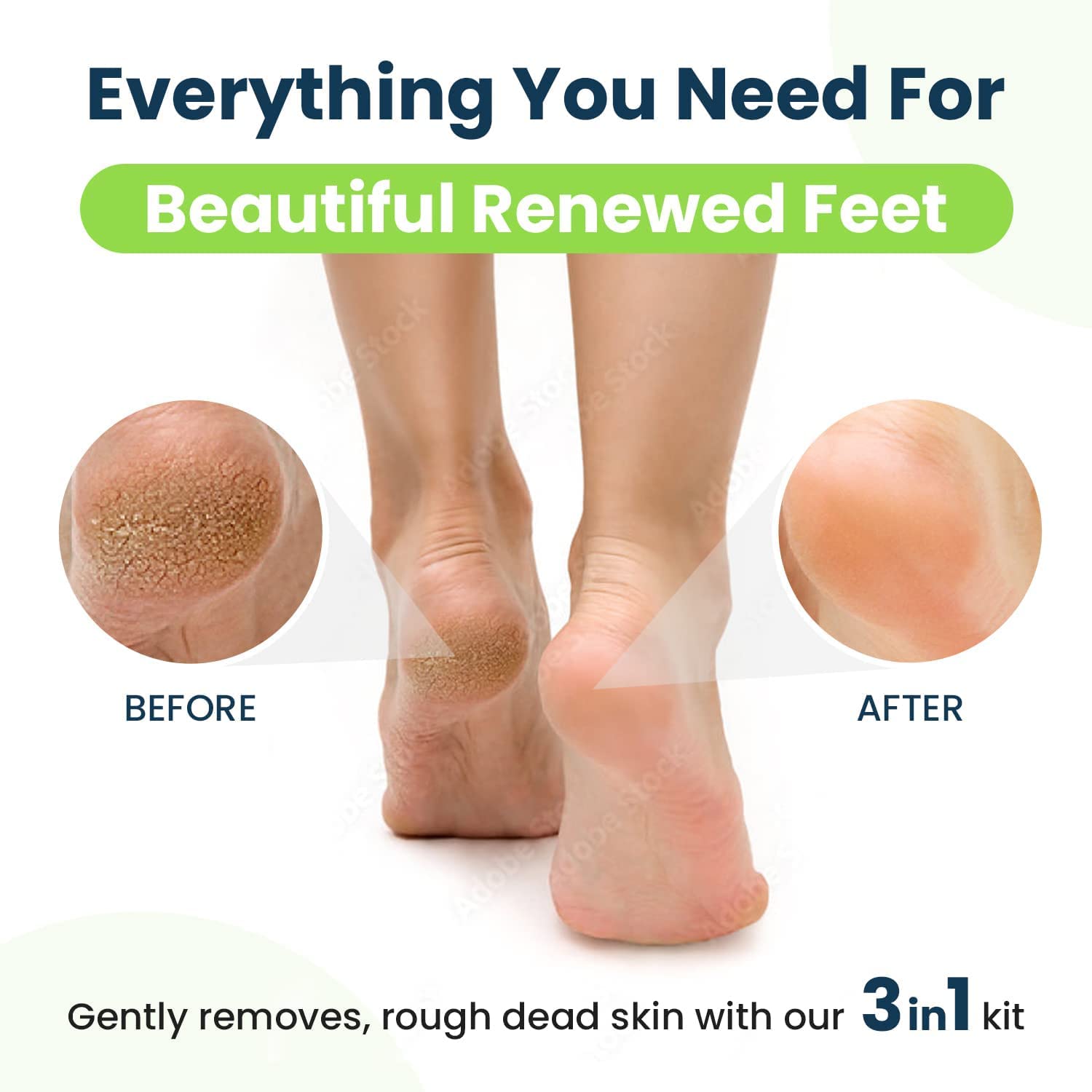 Foot Cure easy at-home foot care for cracked heels and dry skin