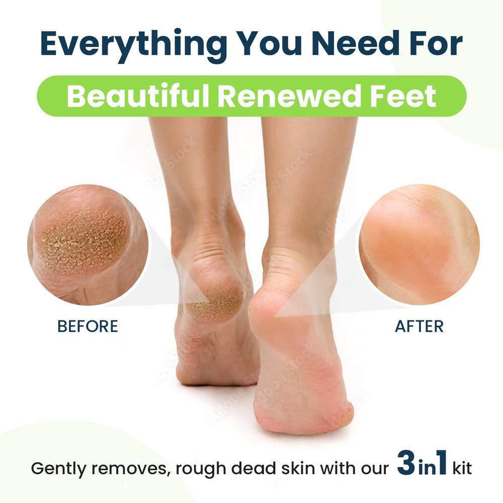 Foot Cure easy at-home foot care for cracked heels and dry skin