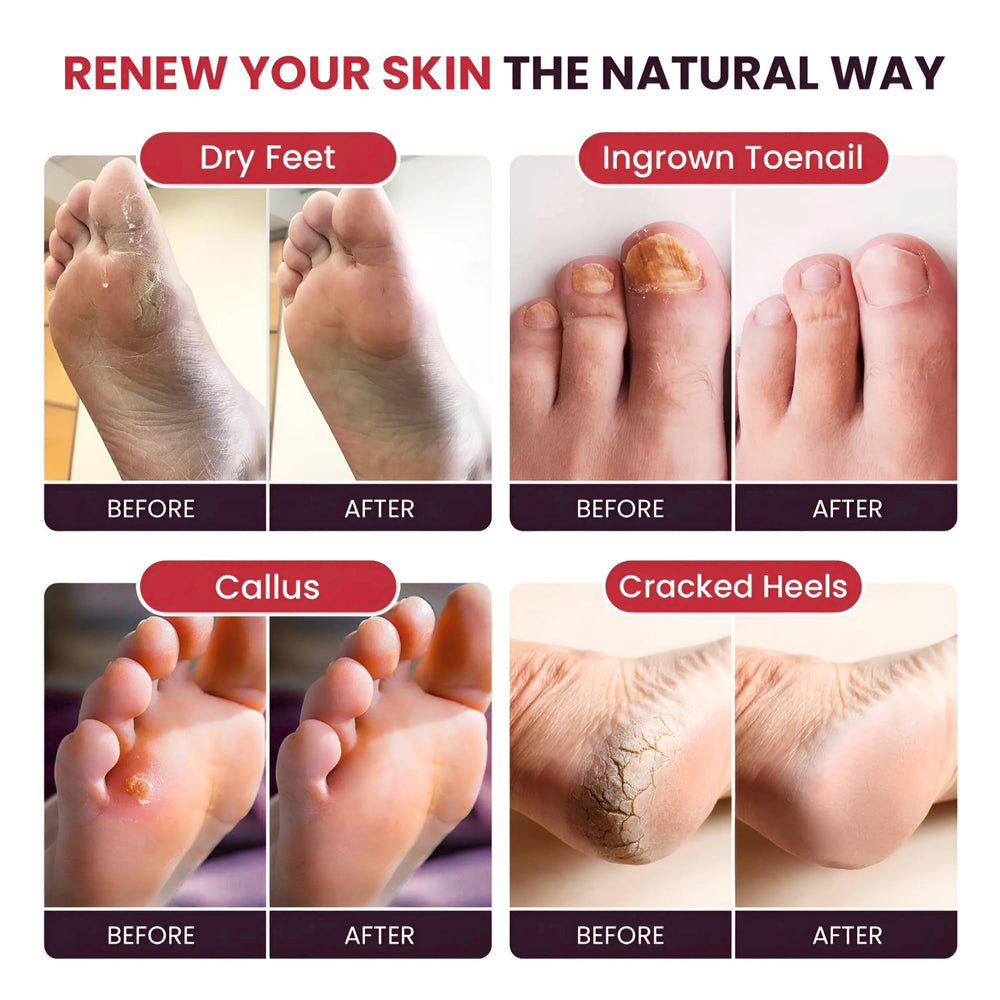 Relaxing bath setup with FOOT CURE foot soak for spa-like experience