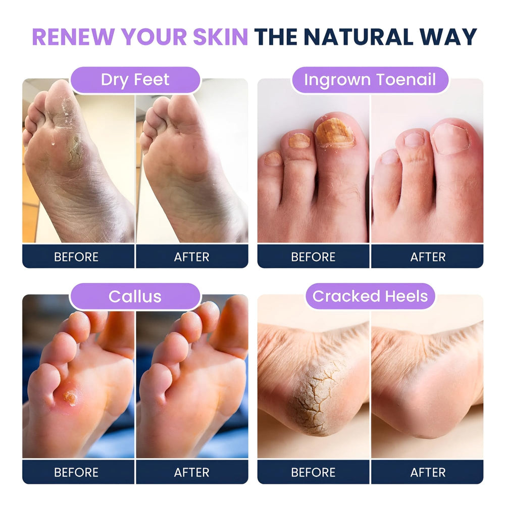 FOOT CURE Relaxed feet with lavender aroma after a soak.