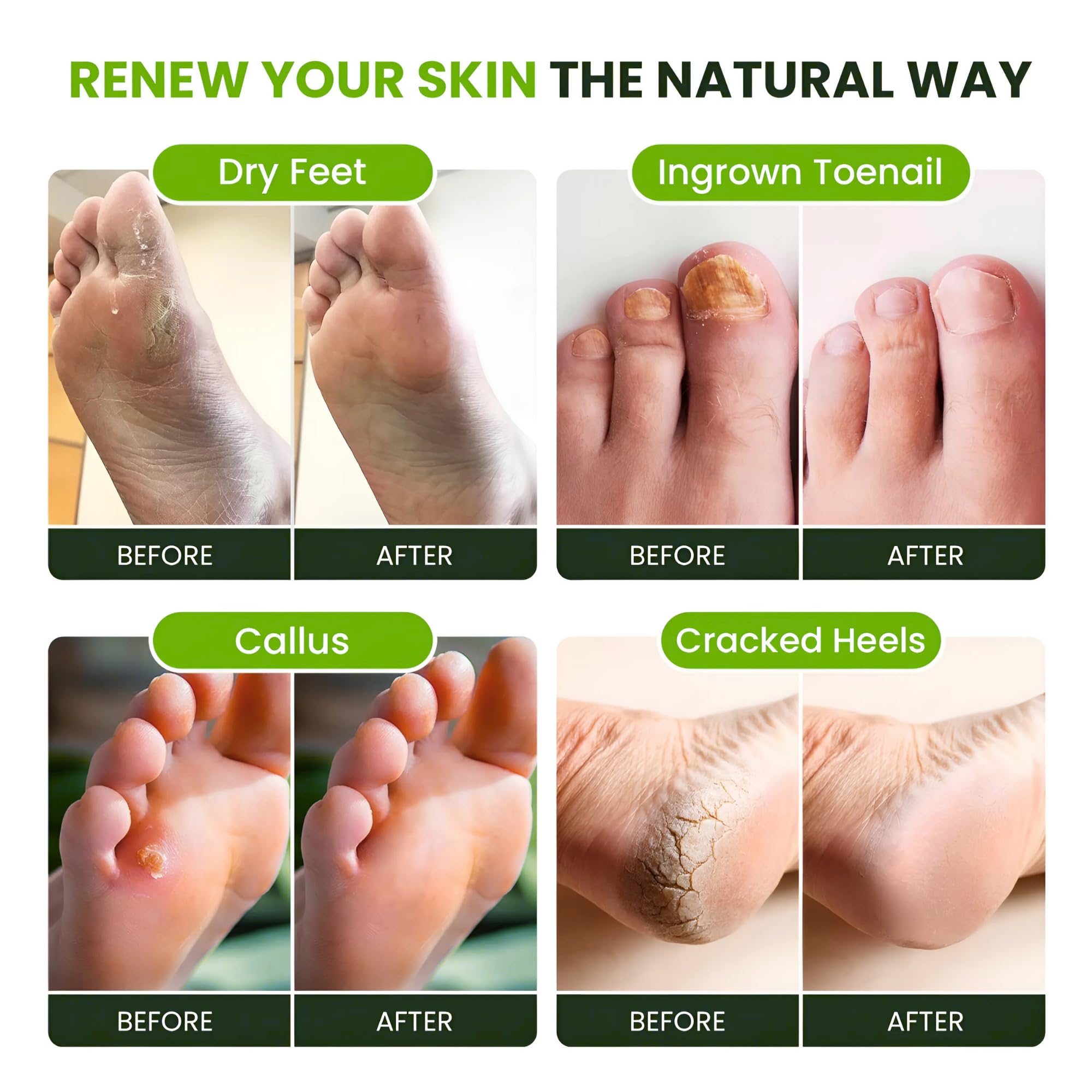 FOOT CURE spa scene showing a calming foot soak setup.
