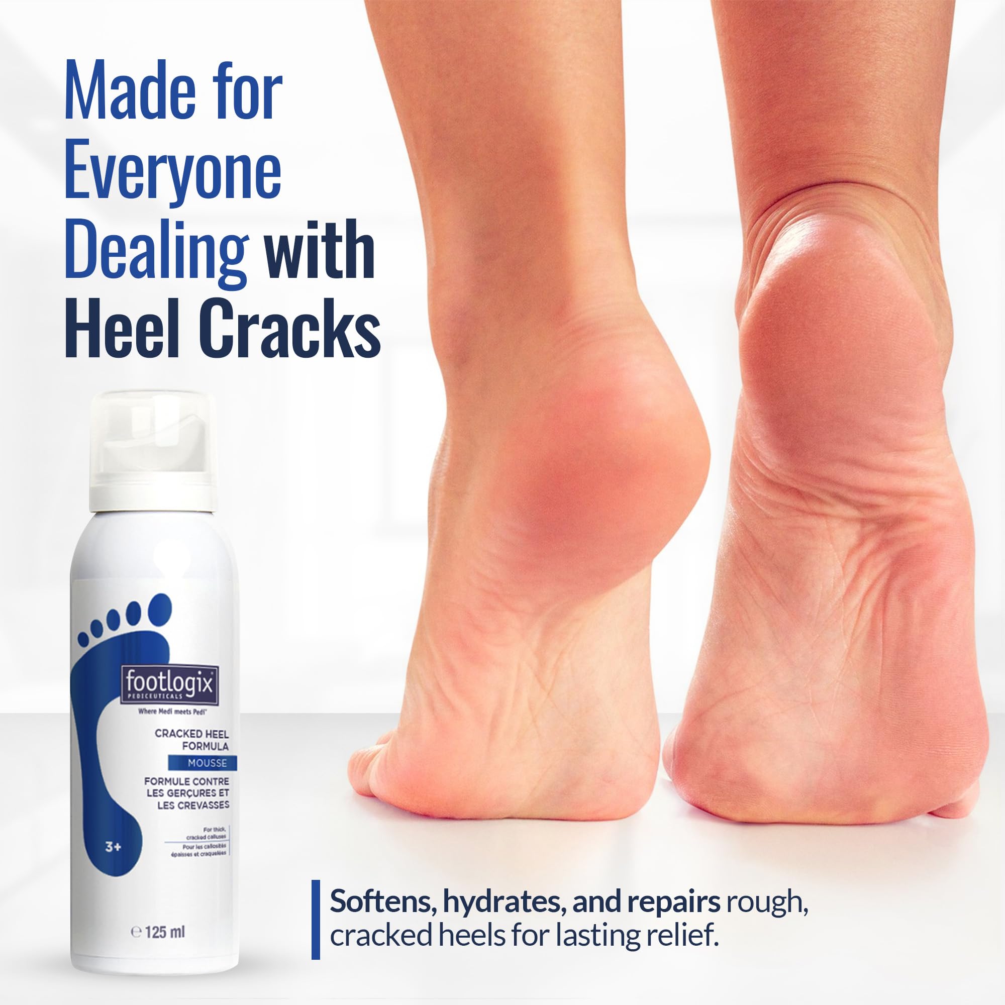 Footlogix Cracked Heel Formula White application demo showing easy rub-in.