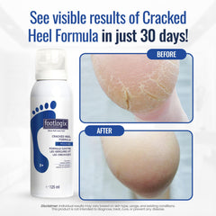 Footlogix Cracked Heel Formula White Evening Primrose oil detail signals nourishing ingredients.