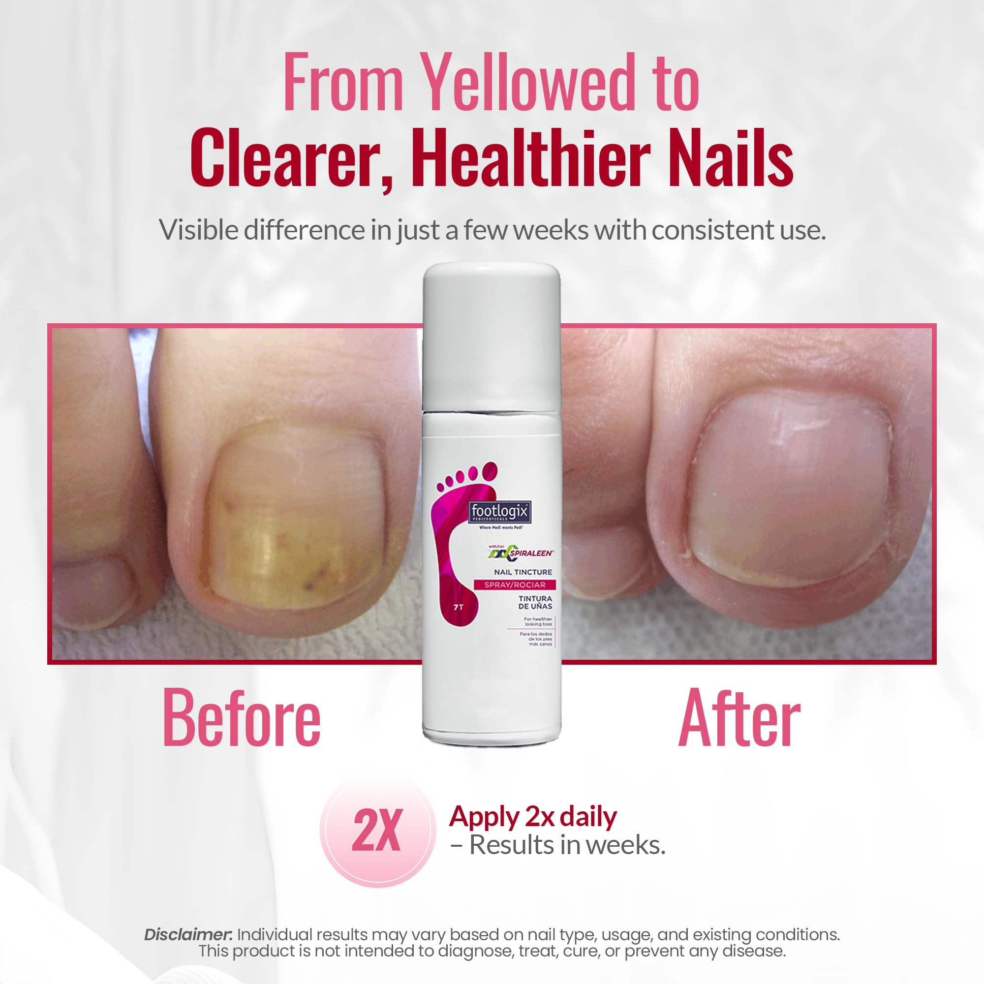 Footlogix Nail Tincture Spray label close-up shows ingredients and purpose.