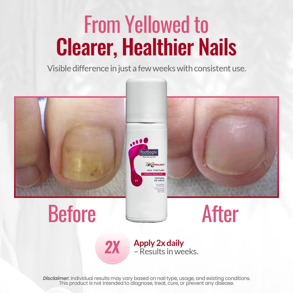 Footlogix Nail Tincture Spray label close-up shows ingredients and purpose.