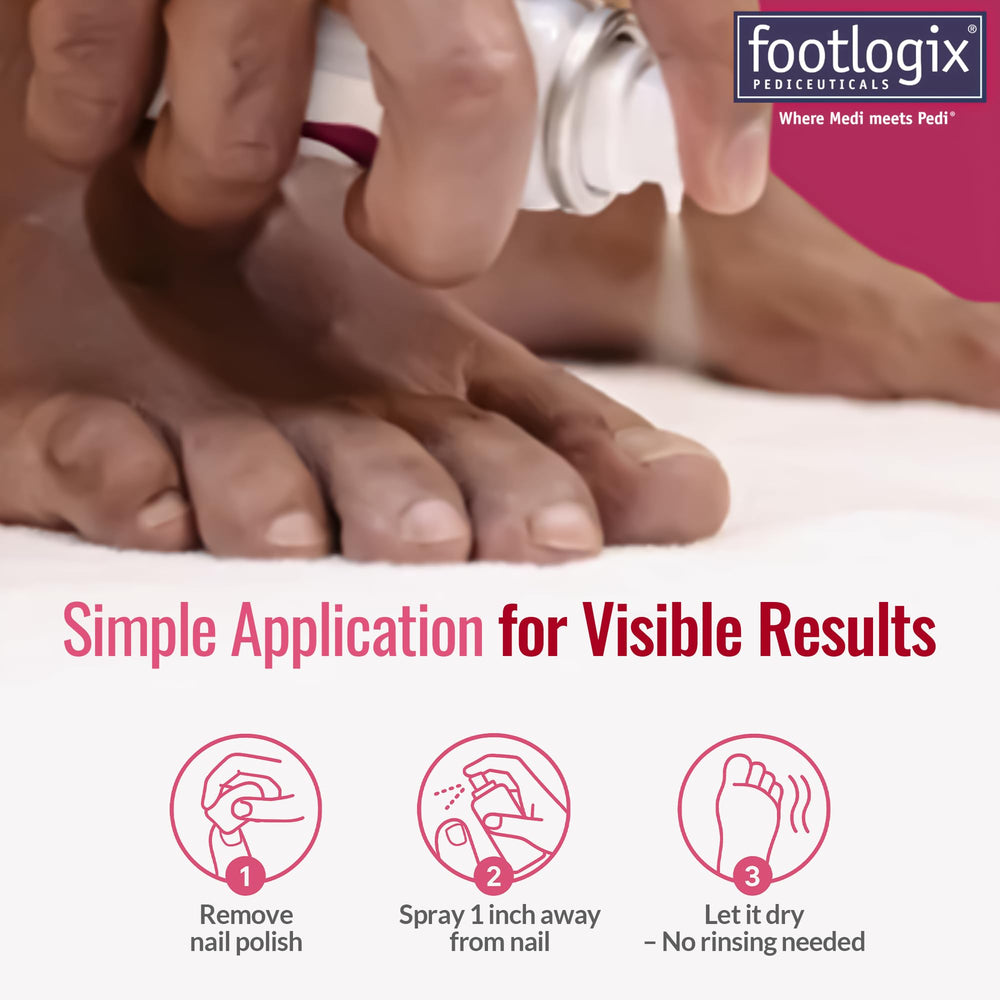Footlogix Nail Tincture Spray packaging emphasizes travel-friendly 1.69 fl oz size.