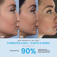Forchics LiftLab blue light mode image suggesting clarifying, refreshing benefits for skin.