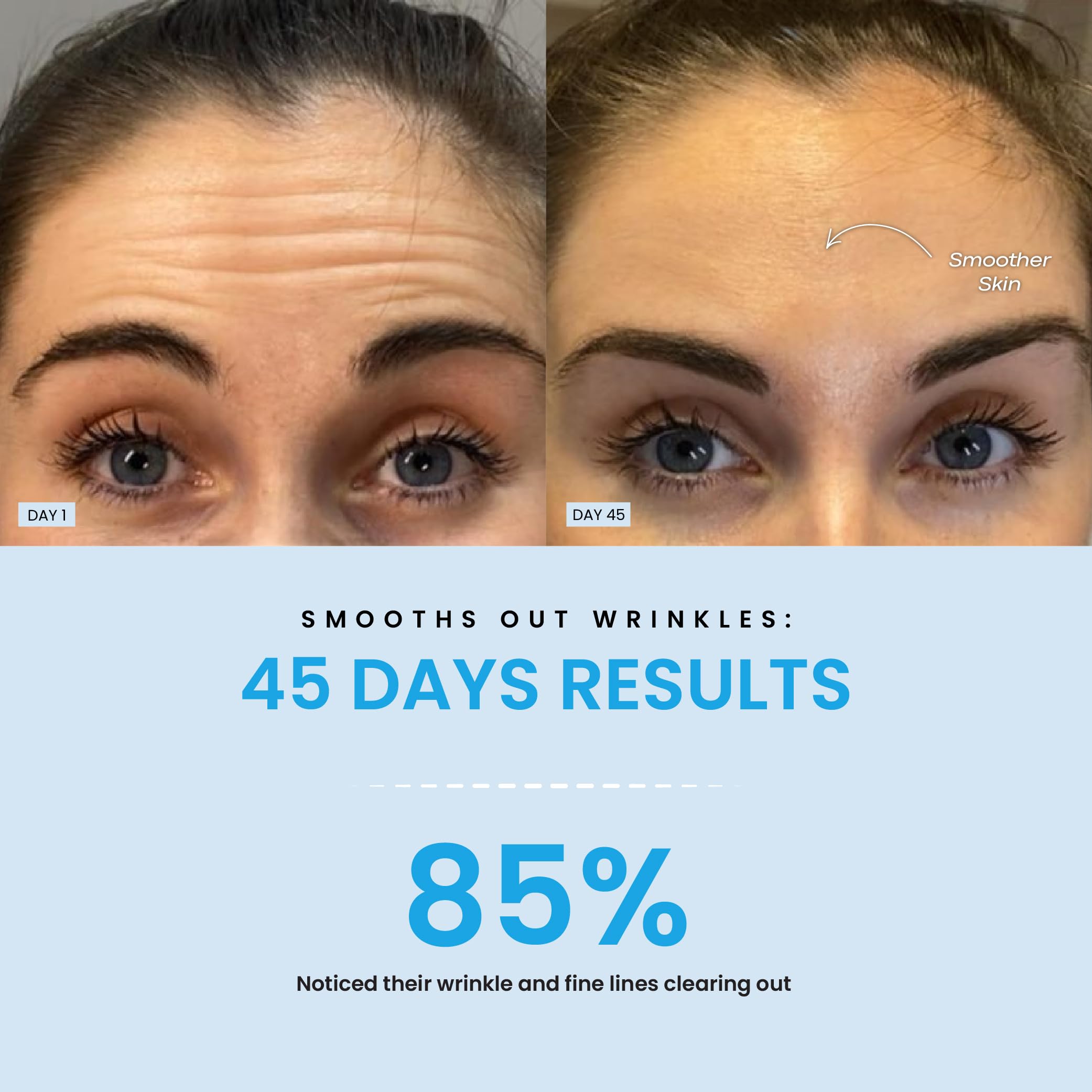 Forchics LiftLab green light mode image associated with calming, balanced complexion.