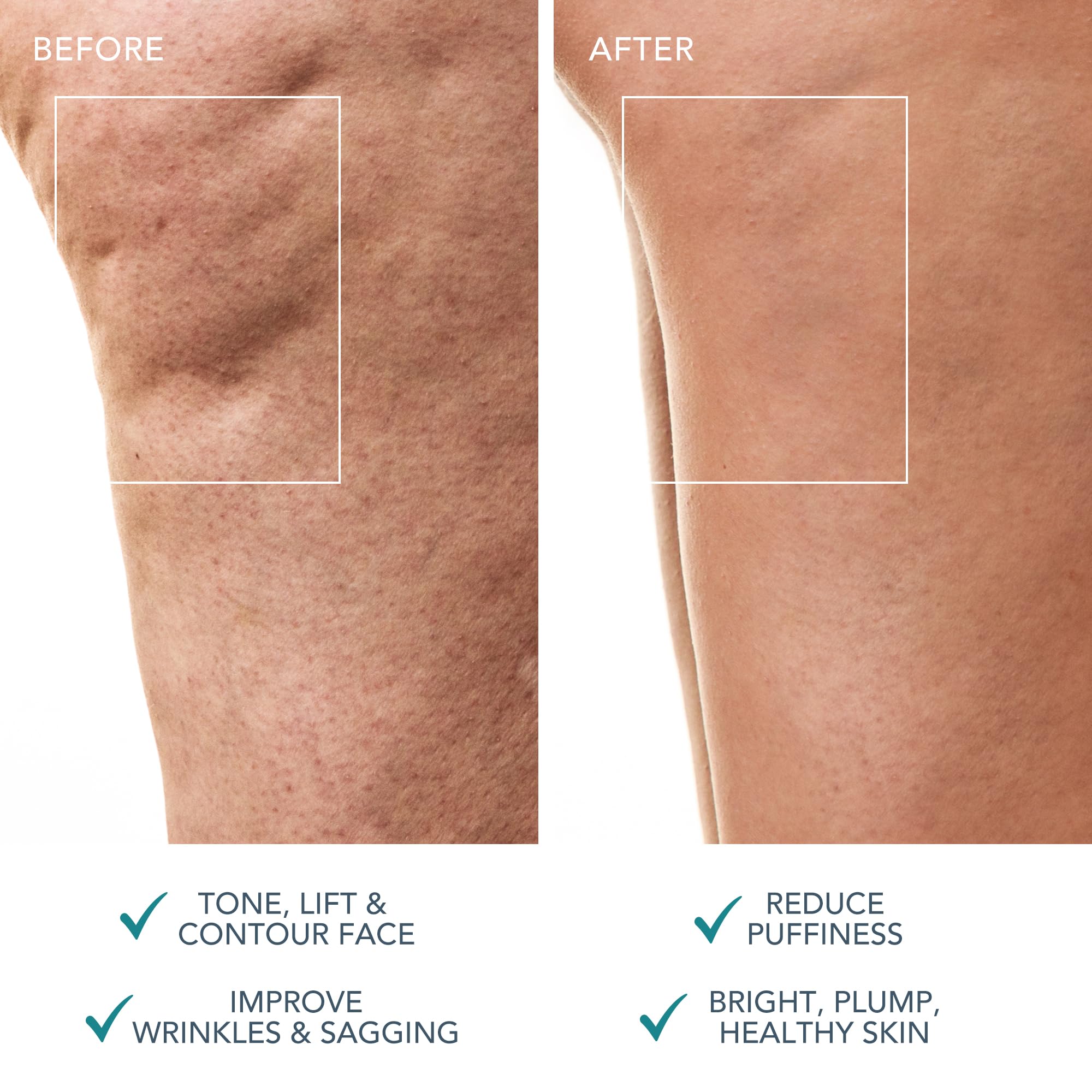 FOREO BEAR 2 body deep tissue massage eases muscle tension during use.