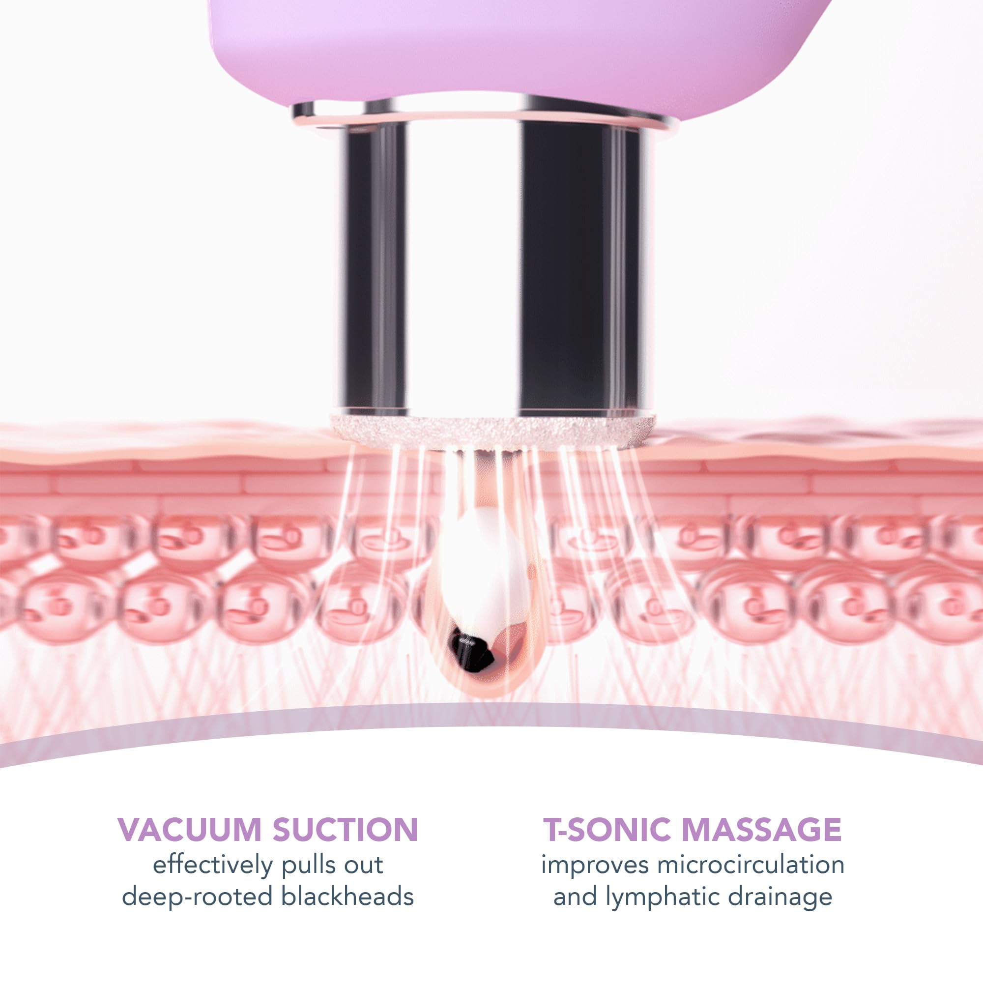 FOREO KIWI blue LED therapy brightens pores and soothes inflammation.