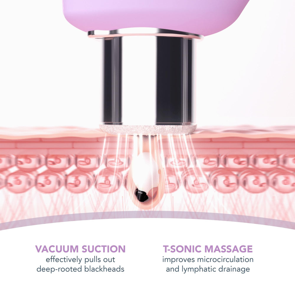 FOREO KIWI blue LED therapy brightens pores and soothes inflammation.