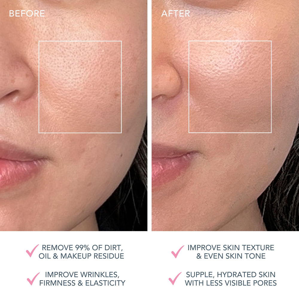FOREO Luna 4 Plus cleansing modes Gentle, Regular, Deep for targeted cleaning.