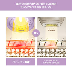 FOREO Peach 2 go 9 cm treatment window covers large areas quickly
