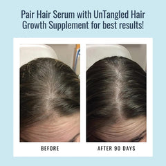 Closeup of Foundation Skincare minoxidil-free formula supporting scalp health