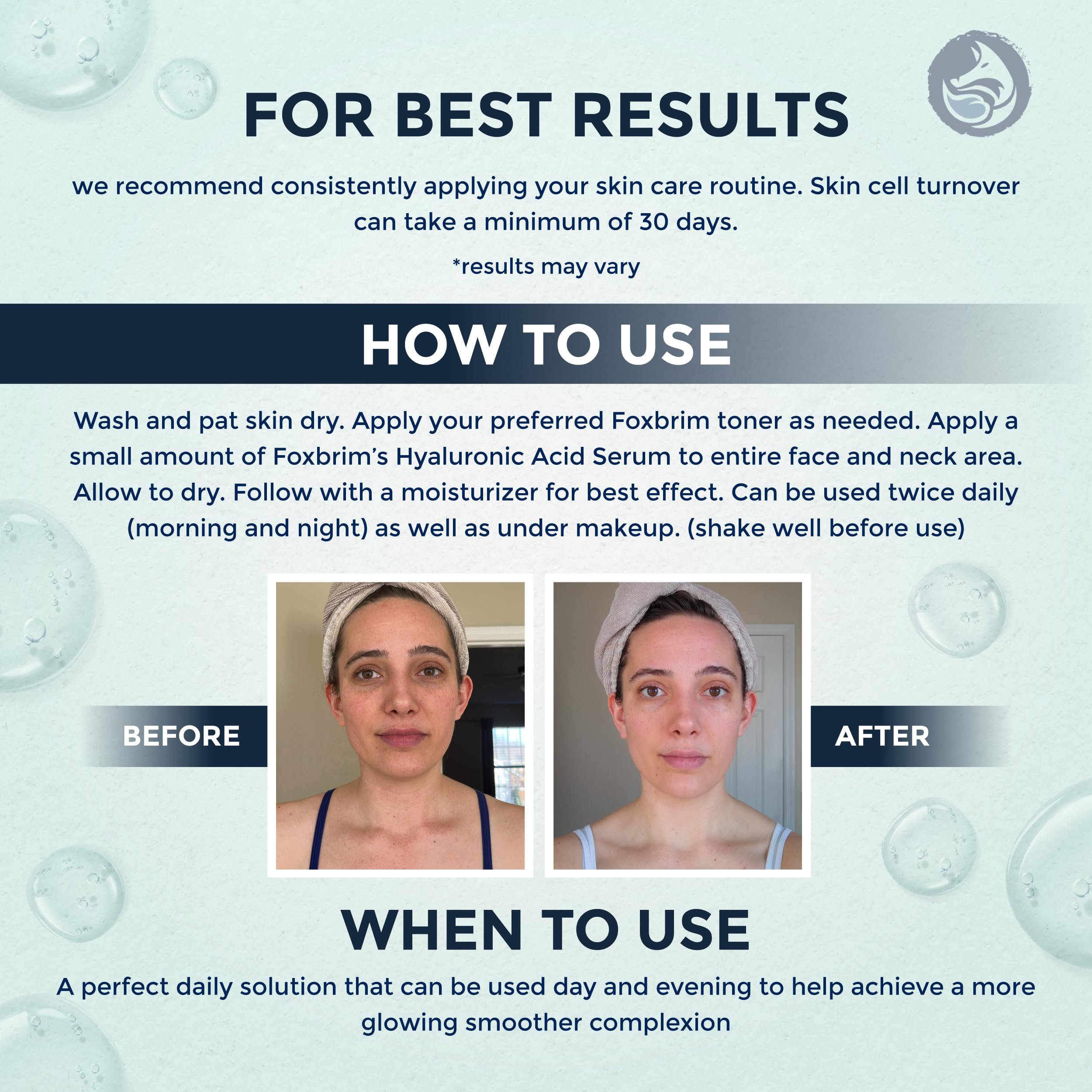 After cleansing, Foxbrim Naturals Hyaluronic Serum refreshes the skin.