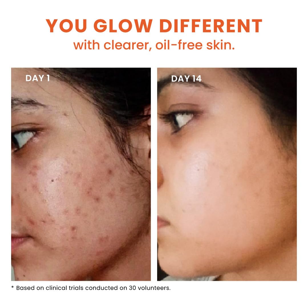 FoxTale oil-control effect shown for a balanced, shine-free complexion.