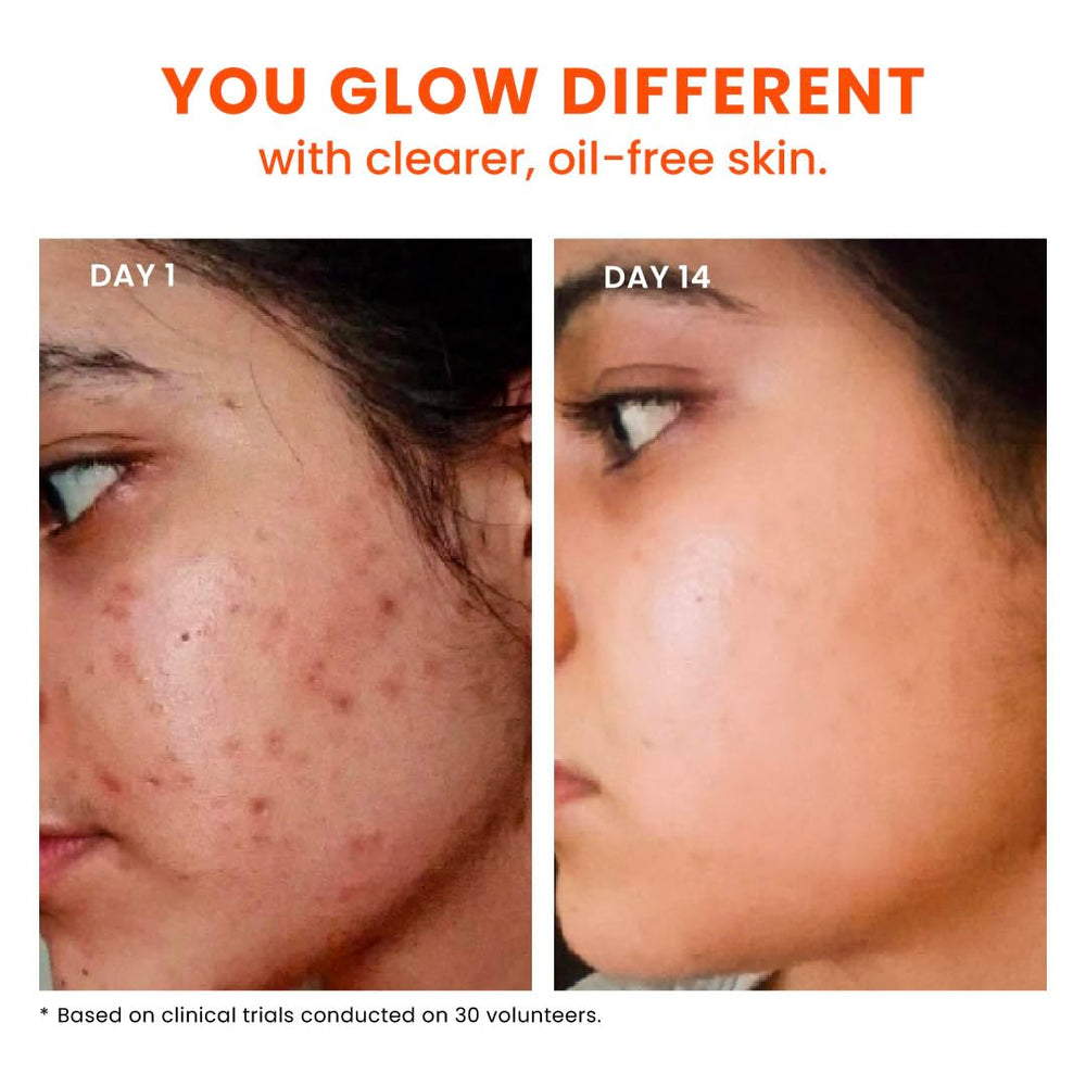 FoxTale oil-control effect shown for a balanced, shine-free complexion.