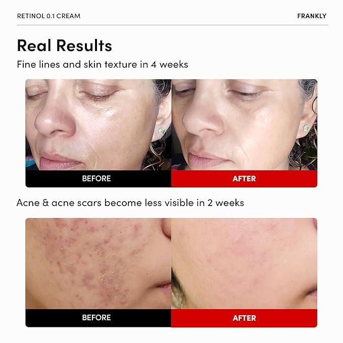 FRANKLY Retinol 0.1% Cream night application with soft focus for overnight replenishment