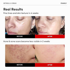 FRANKLY Retinol 0.1% Cream night application with soft focus for overnight replenishment