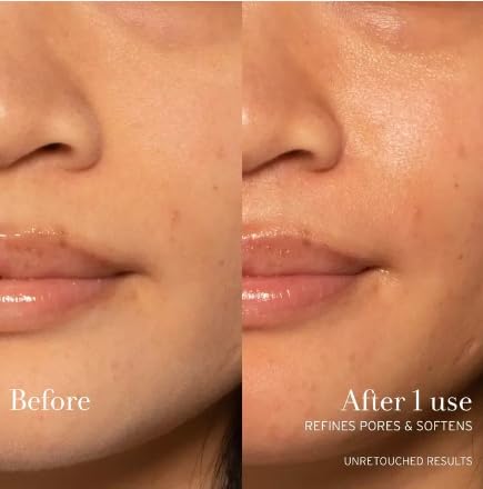 Gentle application of Fresh Rose Toner on the face as part of routine