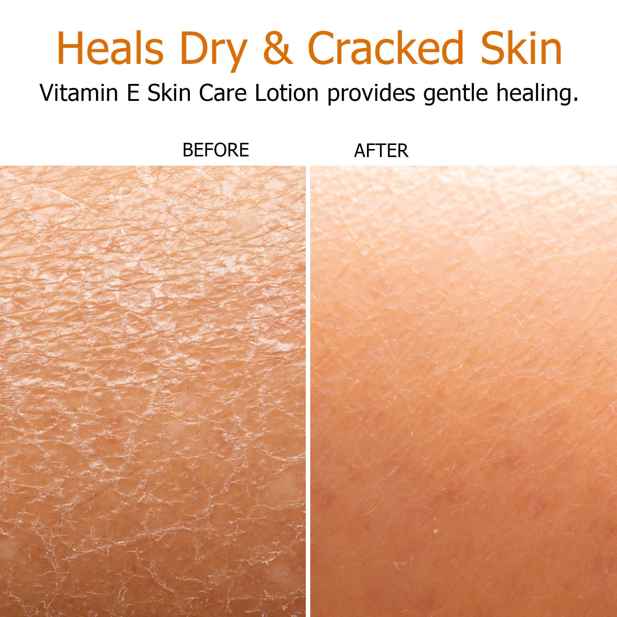Fruit of the Earth Vitamin E Lotion 16oz label close-up highlights vitamin E and aloe