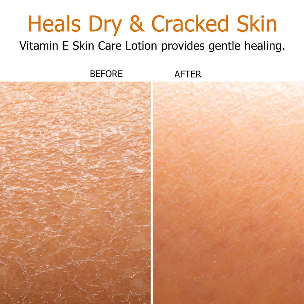 Fruit of the Earth Vitamin E Lotion 16oz label close-up highlights vitamin E and aloe