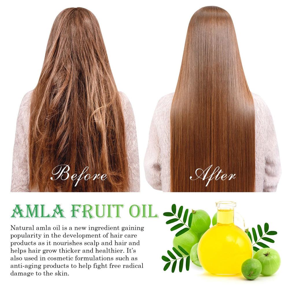 FSLHCY Amla Oil dropper for precise scalp nourishment.