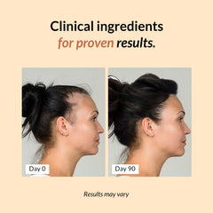FullyVital hair growth capsules closeup ideal for daily use toward fuller hair.