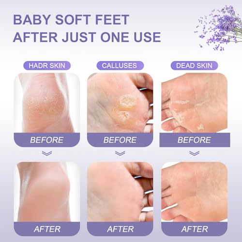 FUNNIR Foot Peeling Mask natural extracts nourish and hydrate skin.