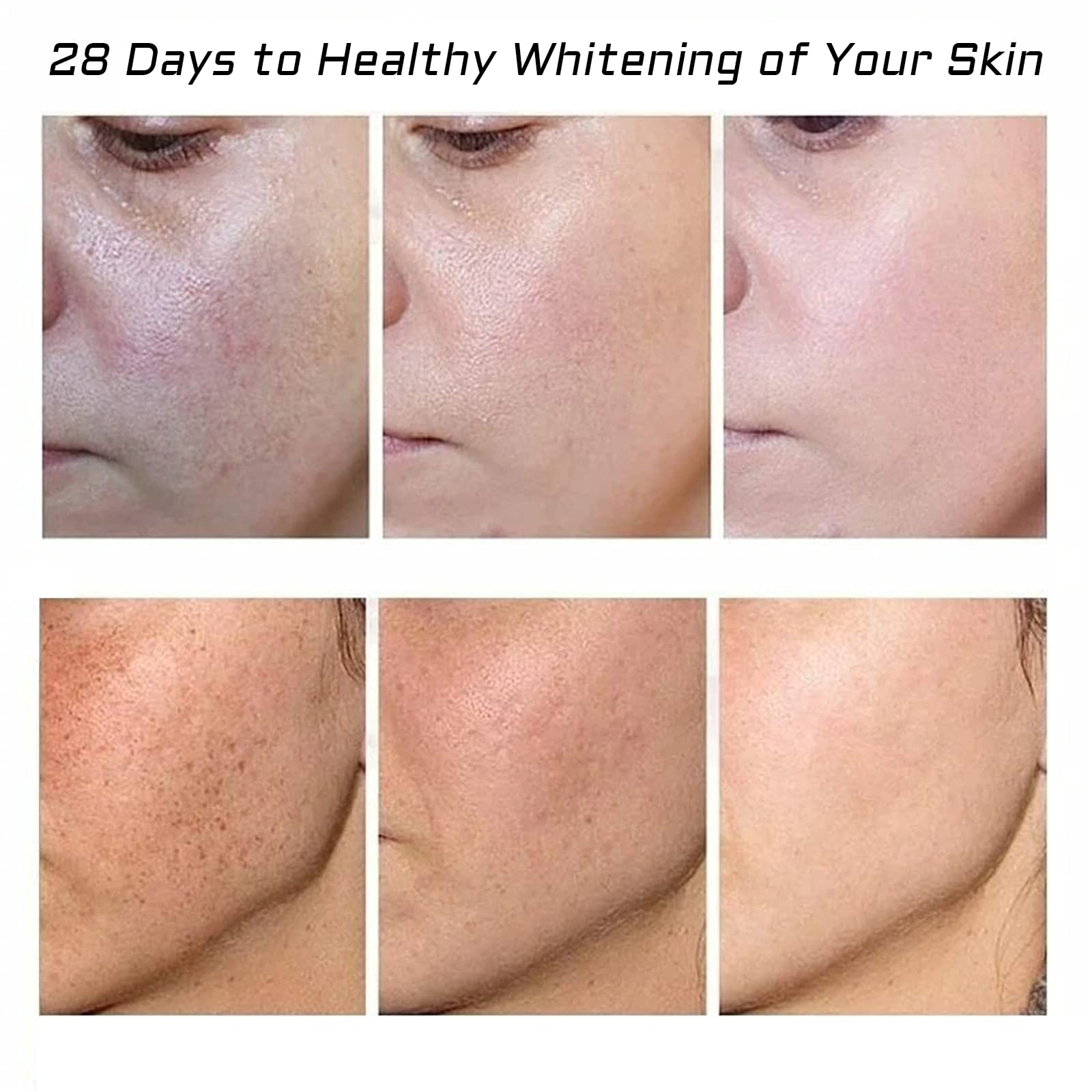 Fupah pigmentation removal cream application for smoother, even skin tone