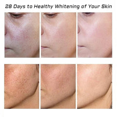 Fupah pigmentation removal cream application for smoother, even skin tone