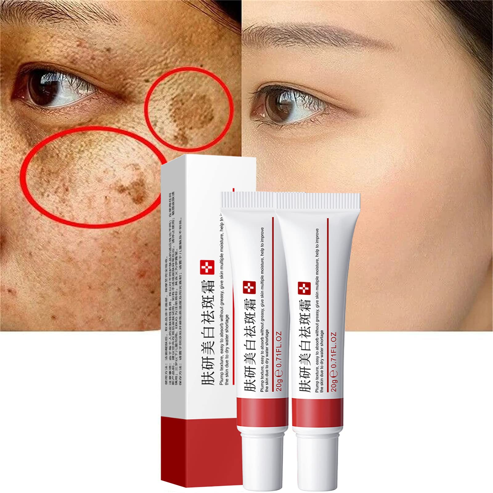 Fupah whitening freckle cream tube for brightness and even tone