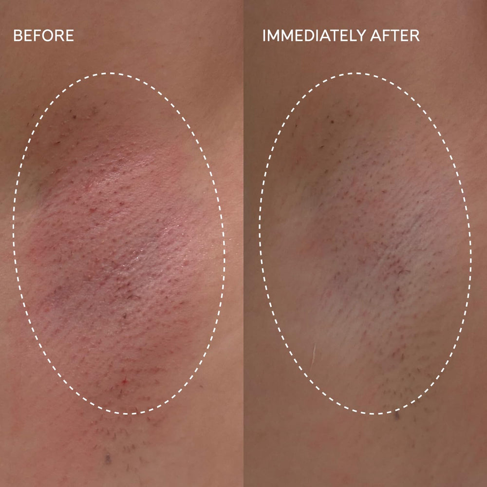 Fur Flash Repair Jelly sensitive-skin design suits delicate areas.