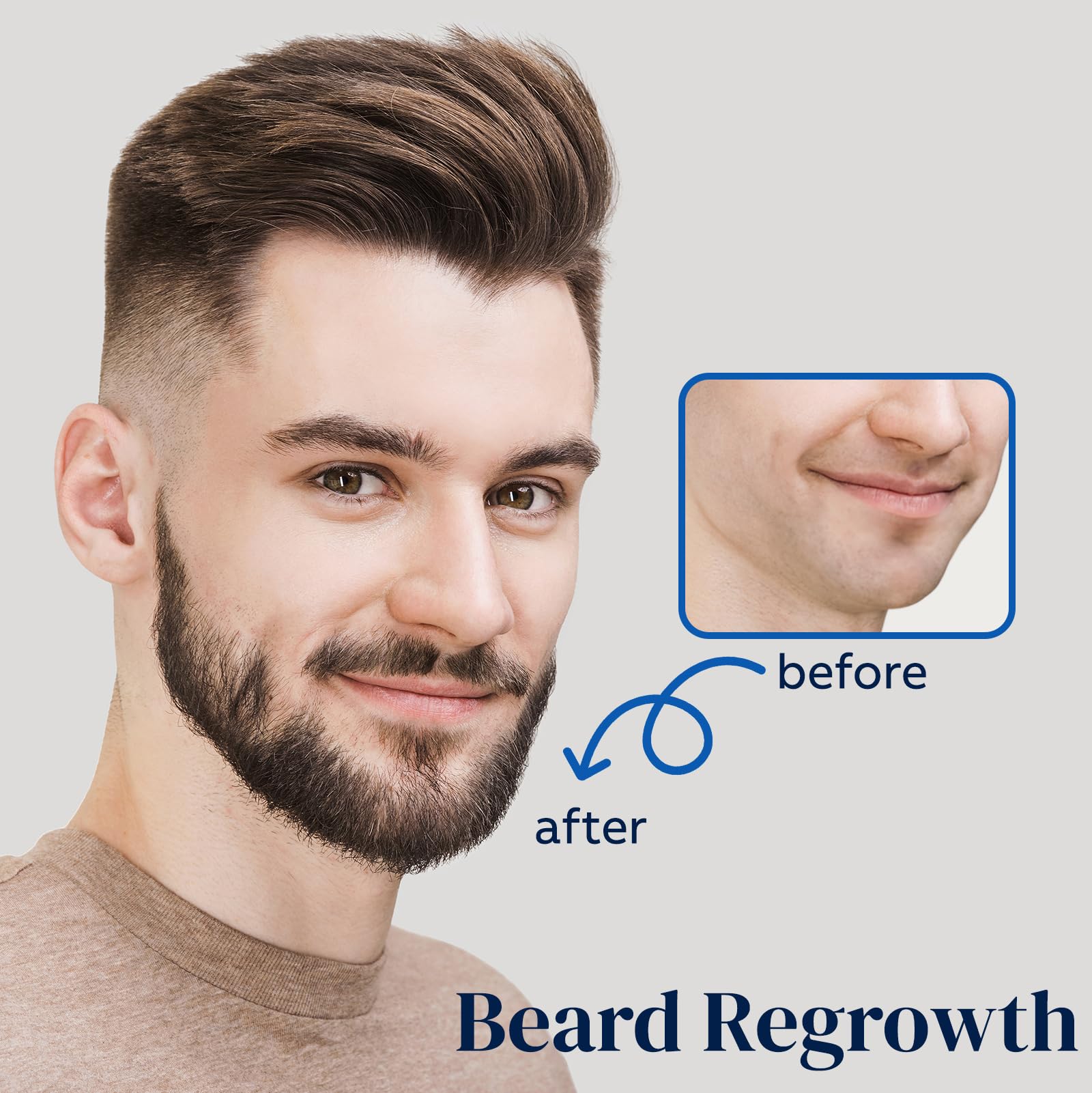 FUZYAT multi-use beard growth spray for facial hair.