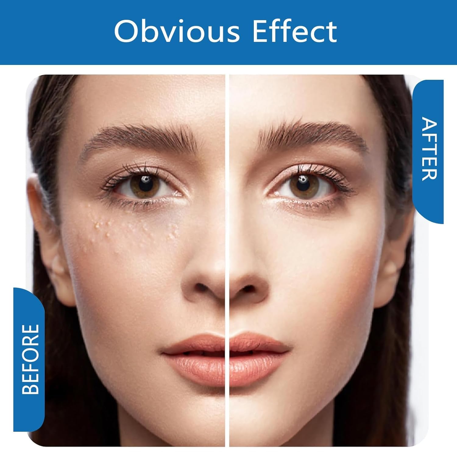 Fvtcnbu MILIA REMOVER serum on eyelids refines texture around the eyes.