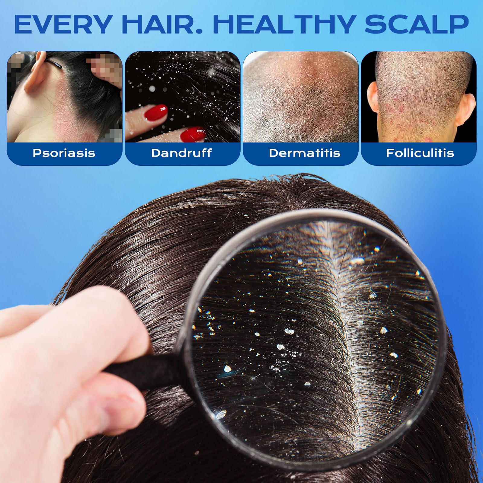 FYZMTL scalp-treatment foam ready for soothing itchy scalps.