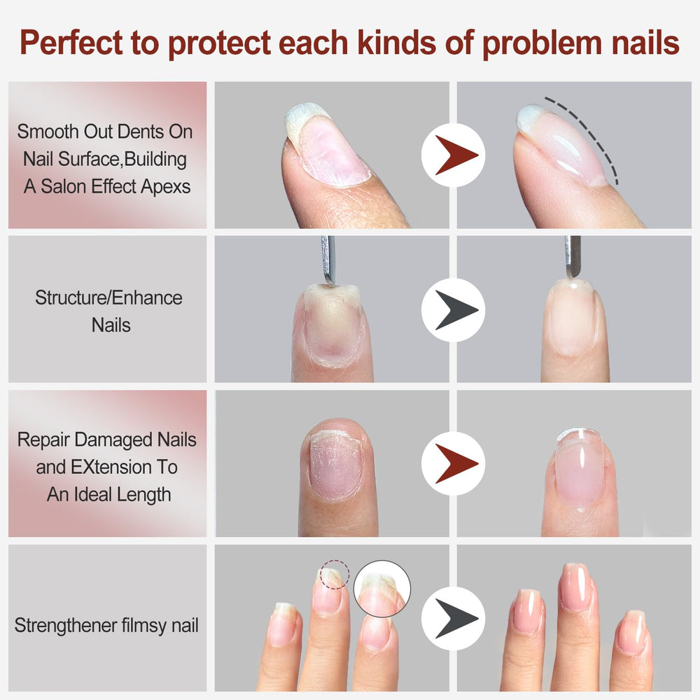 FZANEST nail repair gel supports minor repairs at home.