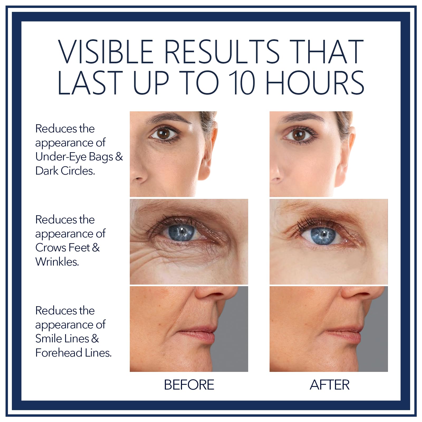 FZBYYLSRG Rapid Reduction Eye Serum helps smooth crow's feet and tighten the eye contour.