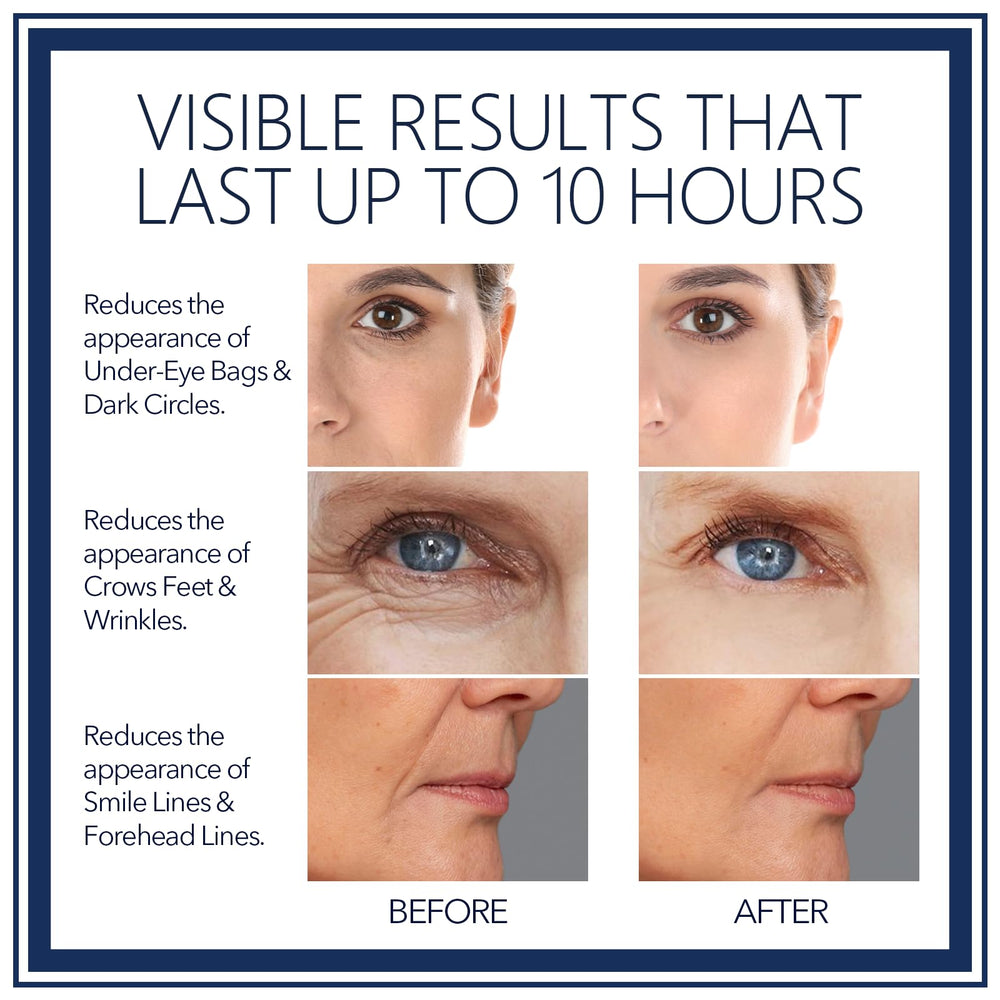 FZBYYLSRG Rapid Reduction Eye Serum helps smooth crow's feet and tighten the eye contour.