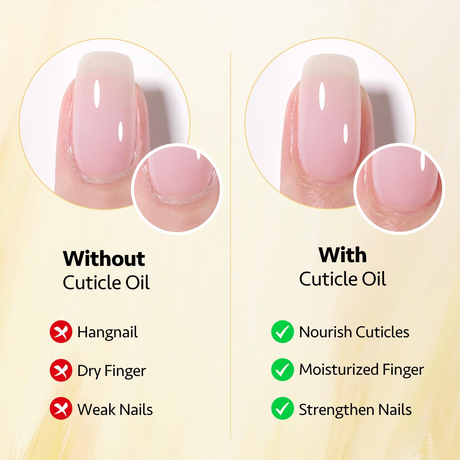 GAOY Cuticle Oil nourishes dry cuticles for a neater appearance.