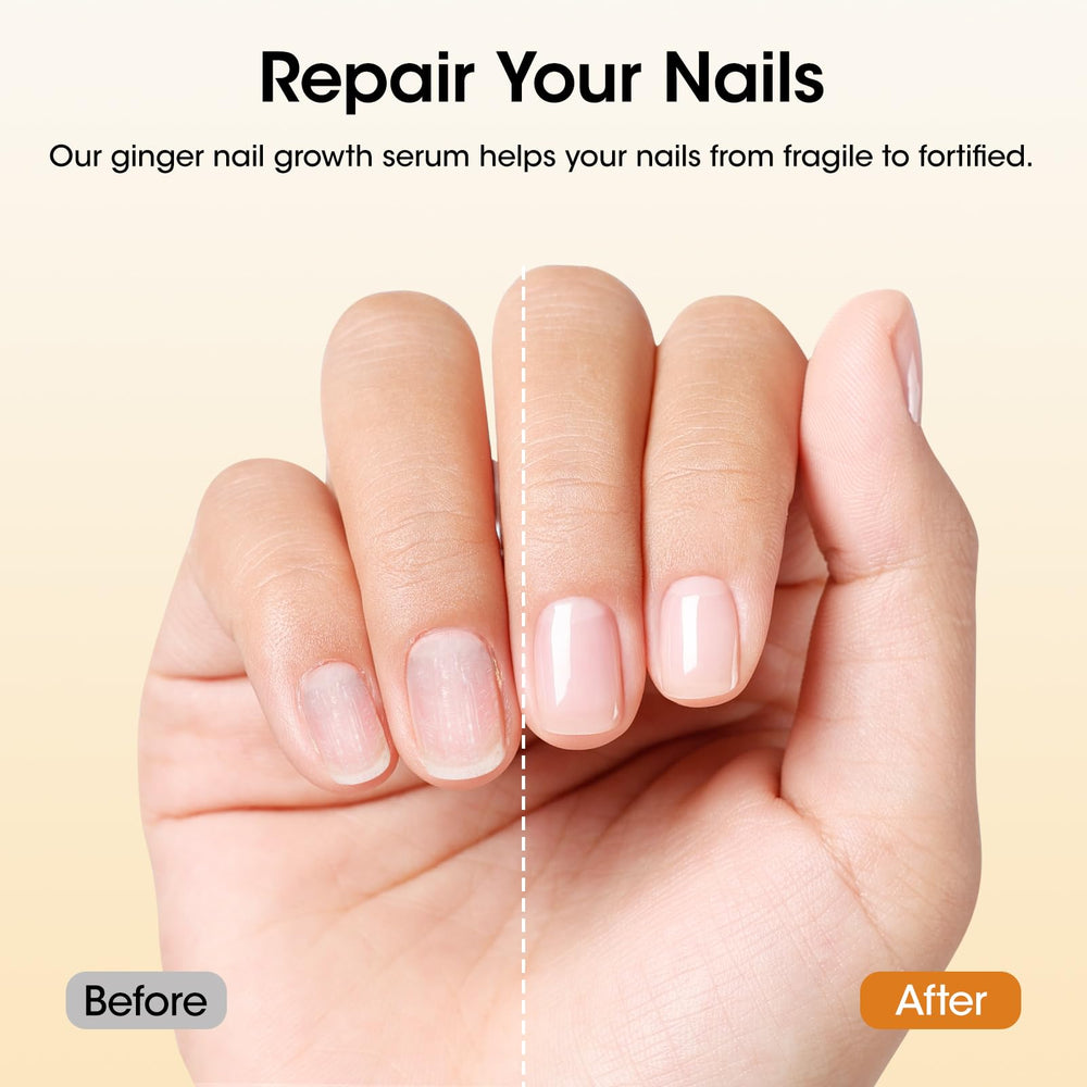 GELLEN Ginger Nail Growth Serum applied to cuticles during routine.