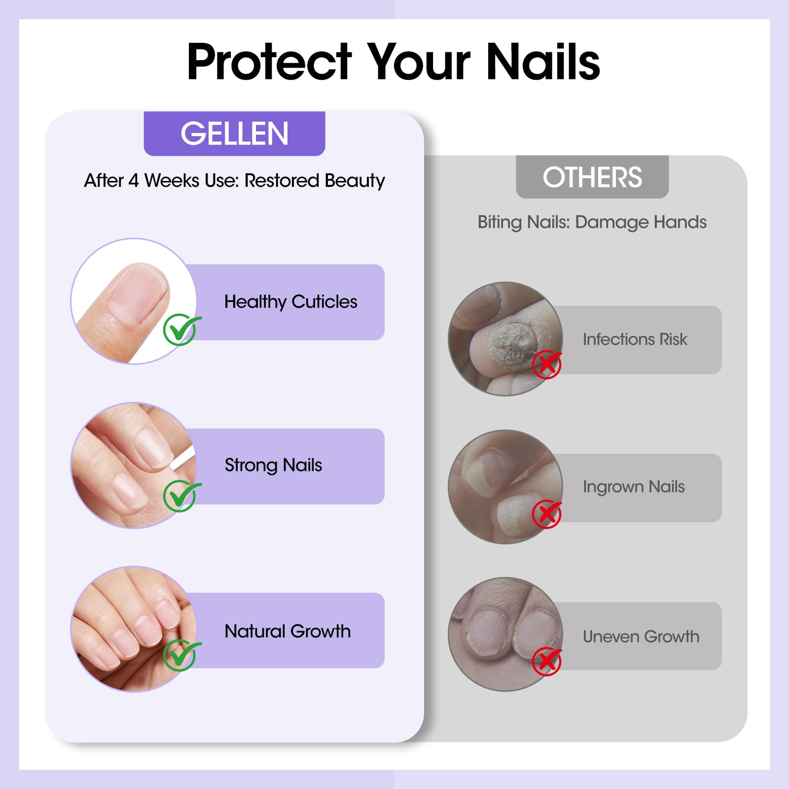 GELLEN Nail Biting Treatment odorless polish with clear finish