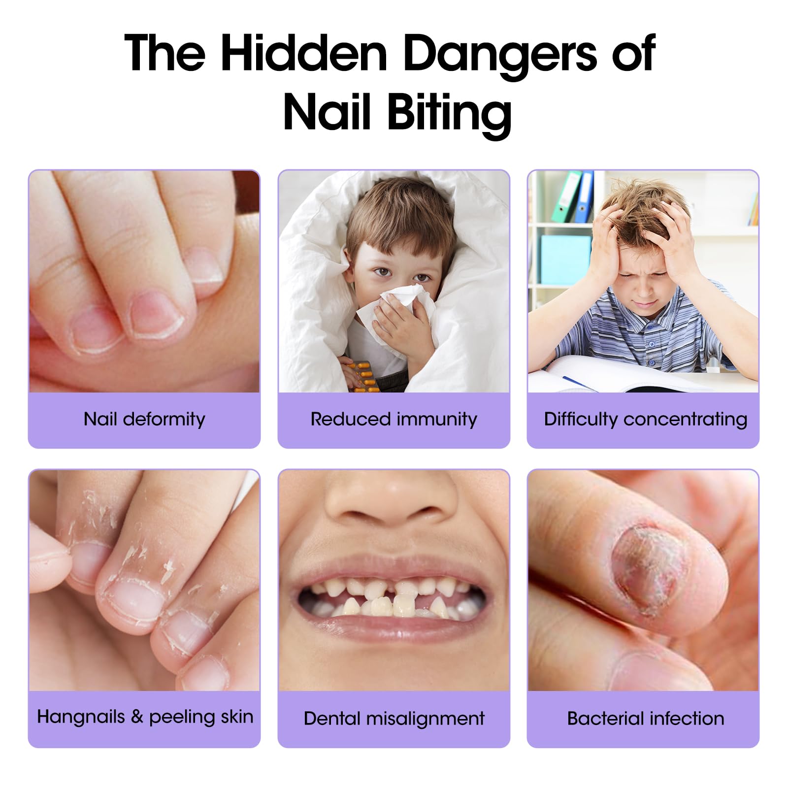 GELLEN Nail Biting Treatment waterproof formula endures handwashing