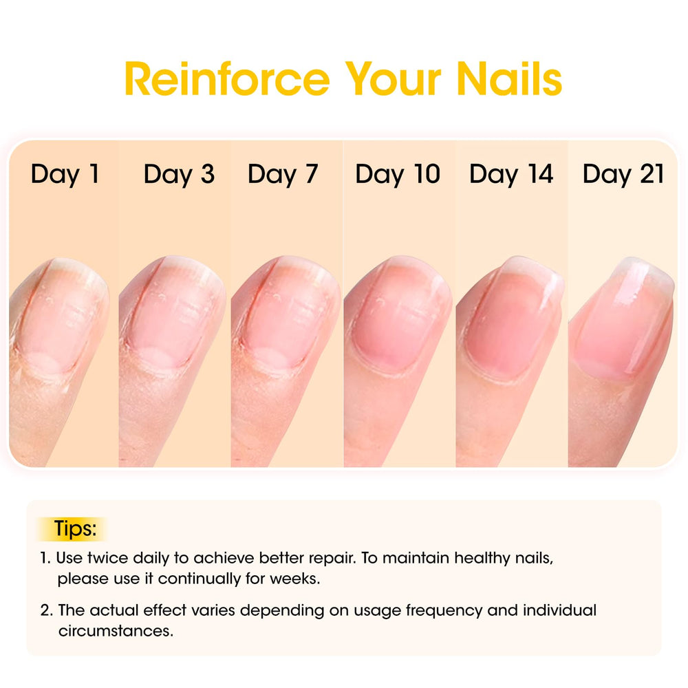 GELLEN Pro Care Calcium Keratin Nourish supports durable nail strength.